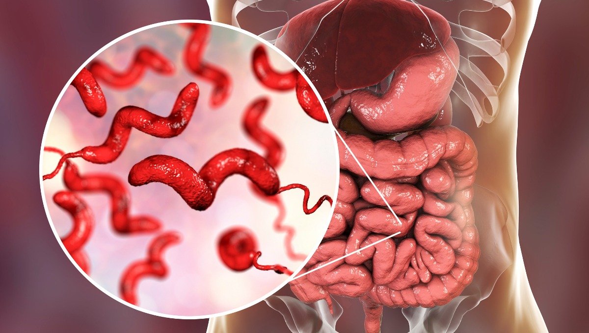Campylobacter infection