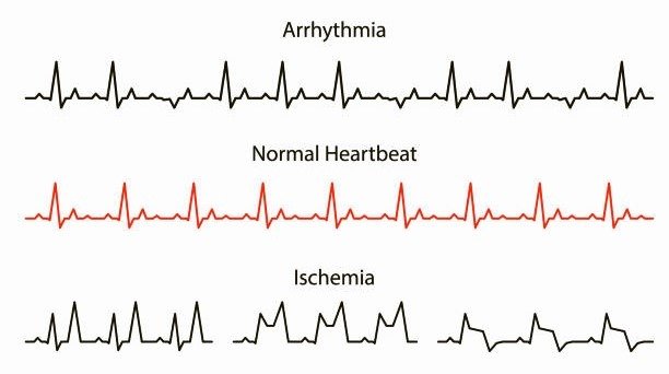 Heart Rate