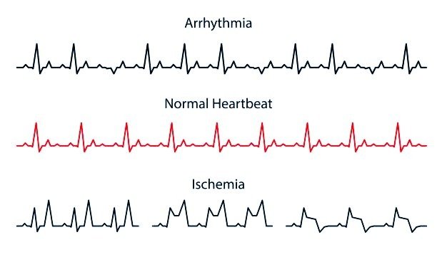 heart beats
