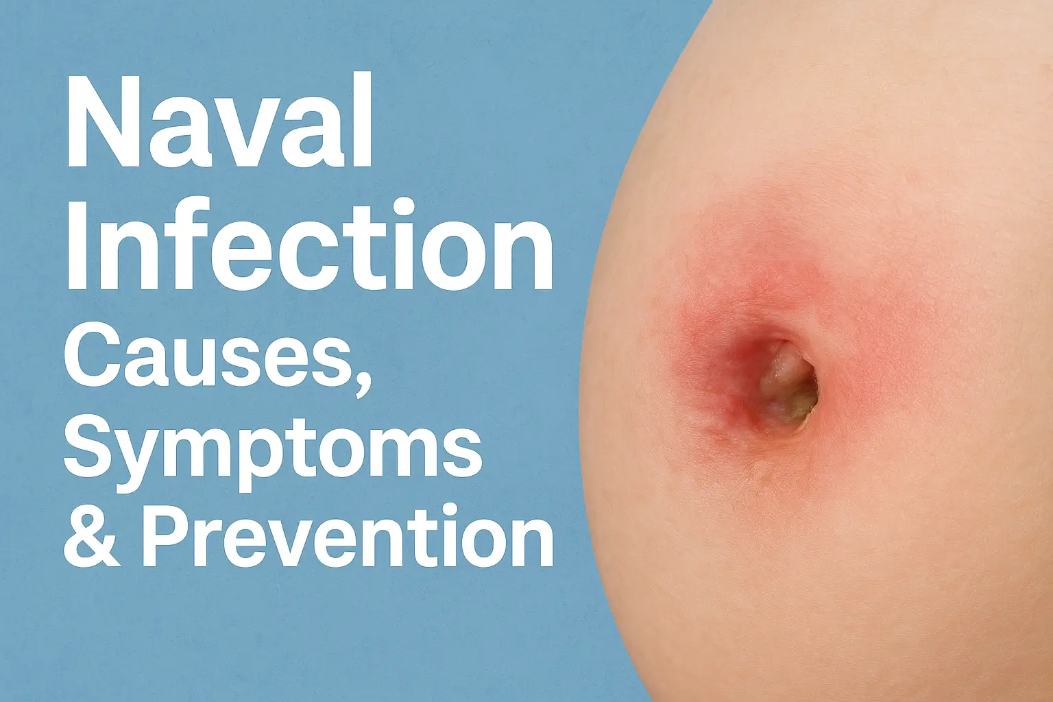 Naval infection showing redness, swelling, and discharge with text overlay