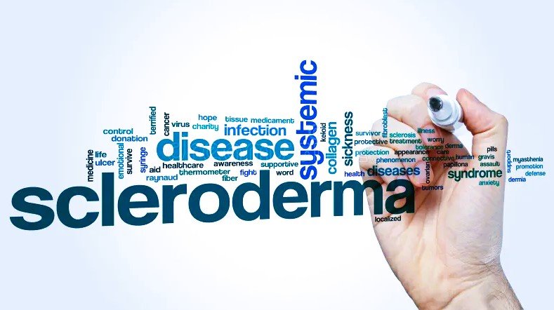 scleroderma